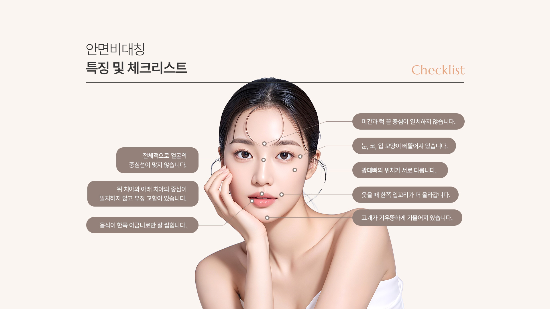 안면비대칭 상세08